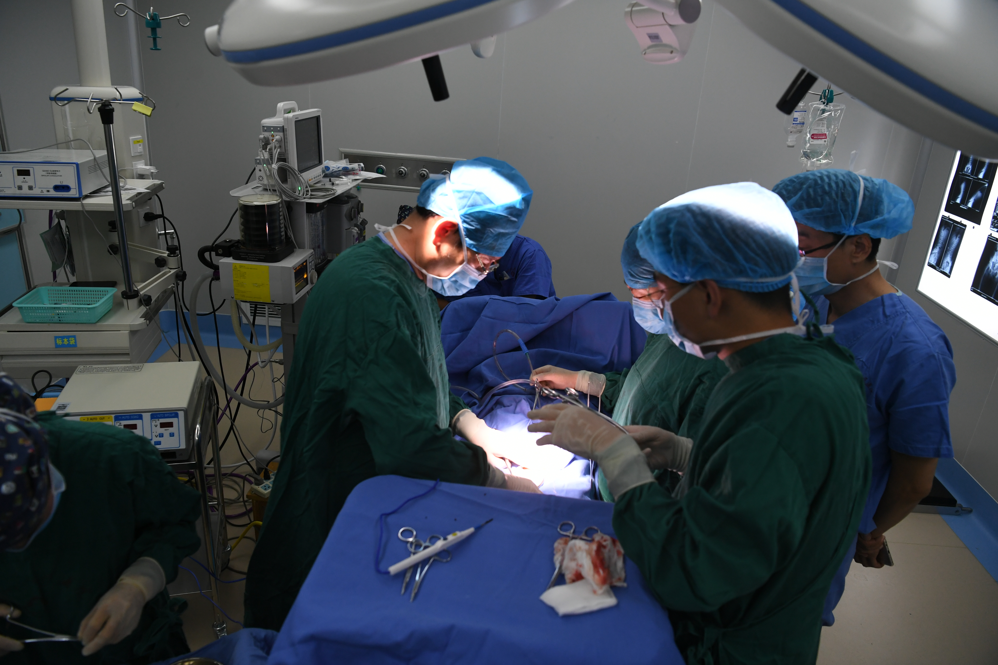 来自北京的专家在迪庆州免费给脑瘫双胞胎儿童做手术