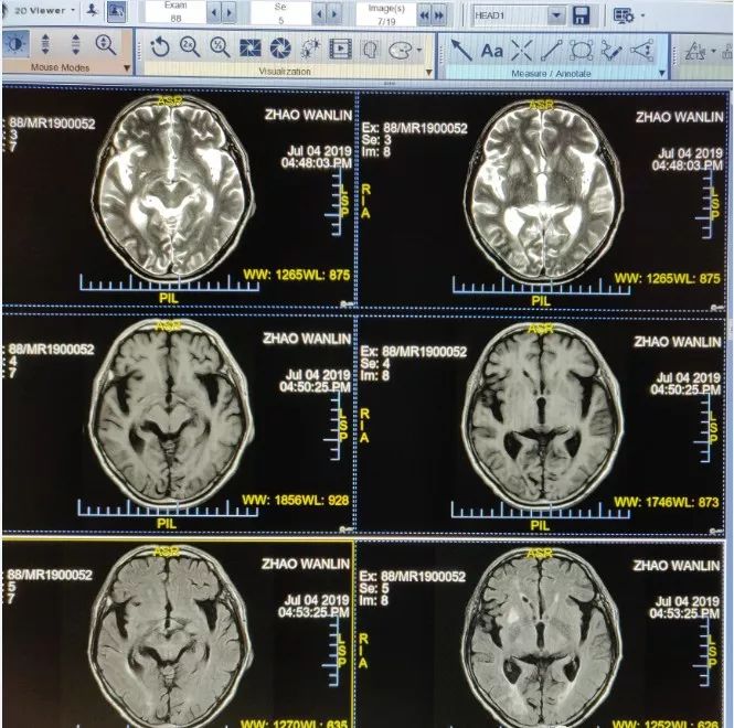 301医院办理住院核磁(MRI)到底有什么区别?的简单介绍