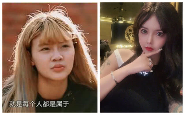 韩安冉小猪整容到底花费多少钱看到金额后网友集体炸锅