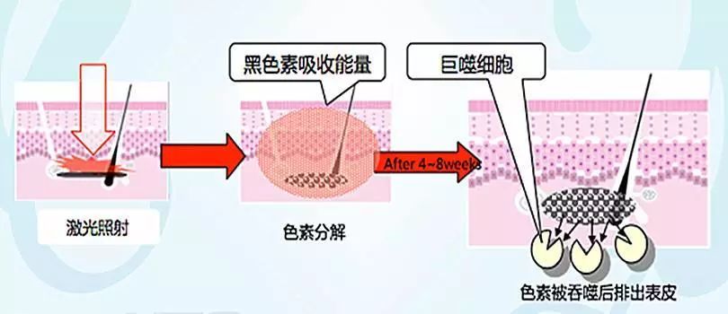 比如晒黑,当皮肤受到紫外线辐射时,黑色素细胞就开始活跃起来,释放黑