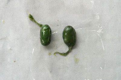 蛇胆全是寄生虫别闹了这要看你怎么吃