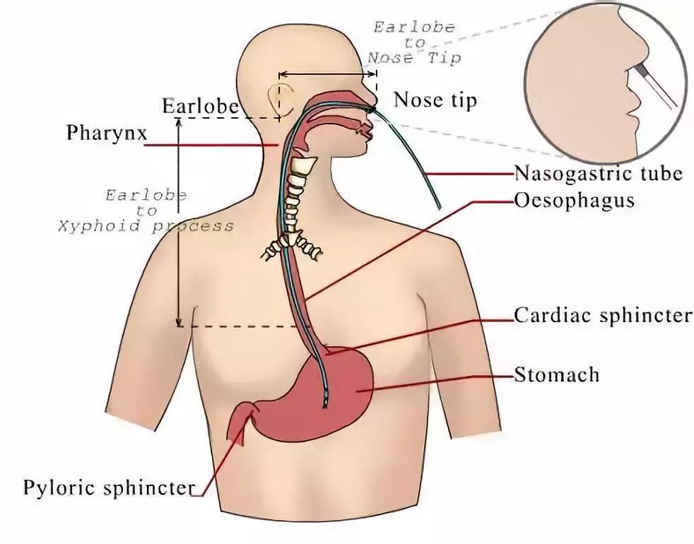 气管与胃管的结构图图片