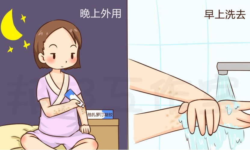 晒太阳时胳膊腿起鸡皮疙瘩(晒太阳时胳膊腿起鸡皮疙瘩痒) 晒太阳时胳膊腿起鸡皮疙瘩(晒太阳时胳膊腿起鸡皮疙瘩痒)