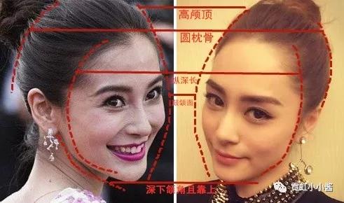 垫眉骨是个又疼又没效果的手术那是因为你没长ab的脸
