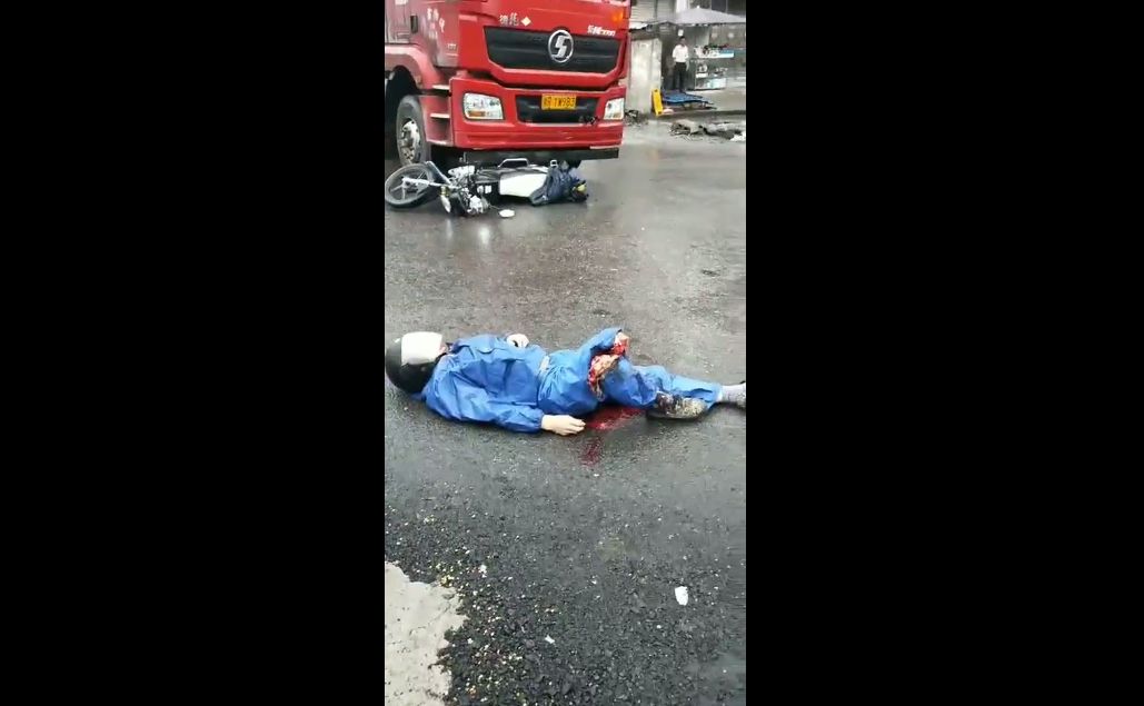 龙山一男子被大货车碾断双腿,场面惨烈!