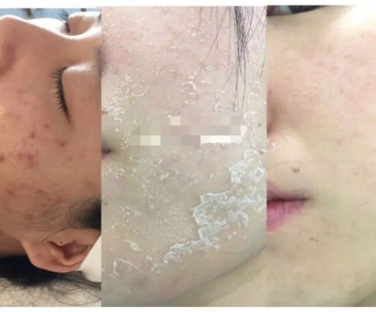 张韶涵是有多缺钱,黄金焕肤这种广告也打?_海藻