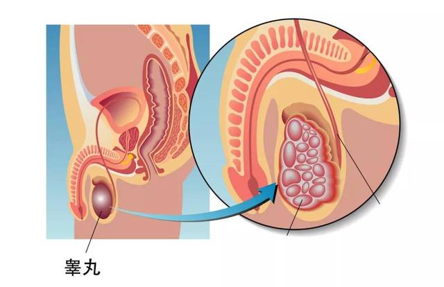 甚至有人会因睾丸疼痛发生晕厥