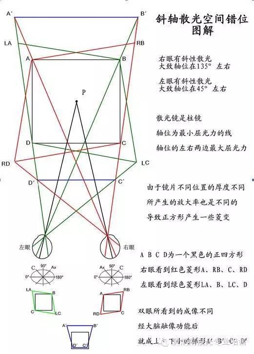 斜轴散光图片