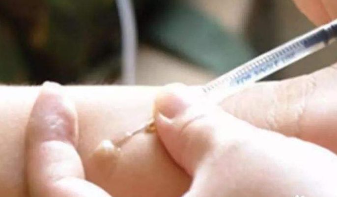 这21个药不是抗生素,但必须做皮试!-搜狐大视野-搜狐新闻