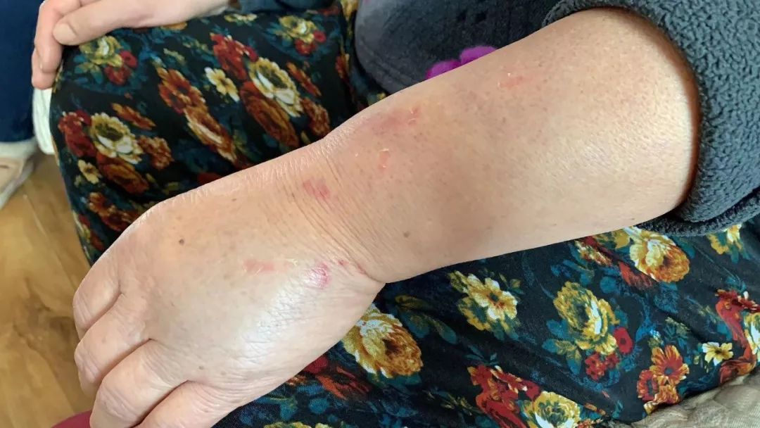 我妈说,当时狗是