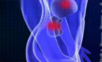 400_242gif 动态图 动图