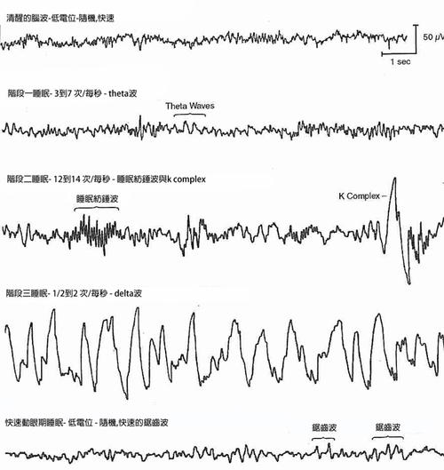 心理学家一个人的睡眠周期由四或五个阶段组成