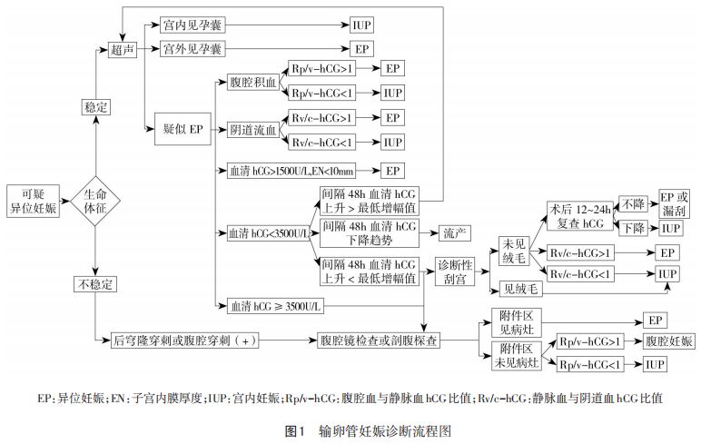 异位妊娠思维导图模板图片