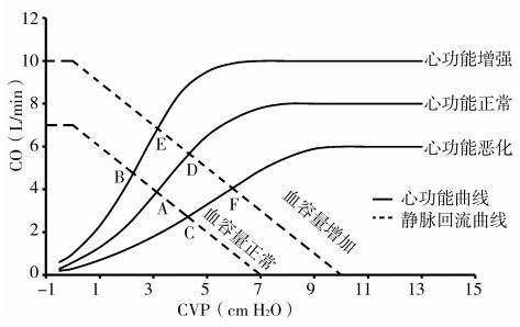重症患者中心静脉压怎么用cvp监测结果准确吗