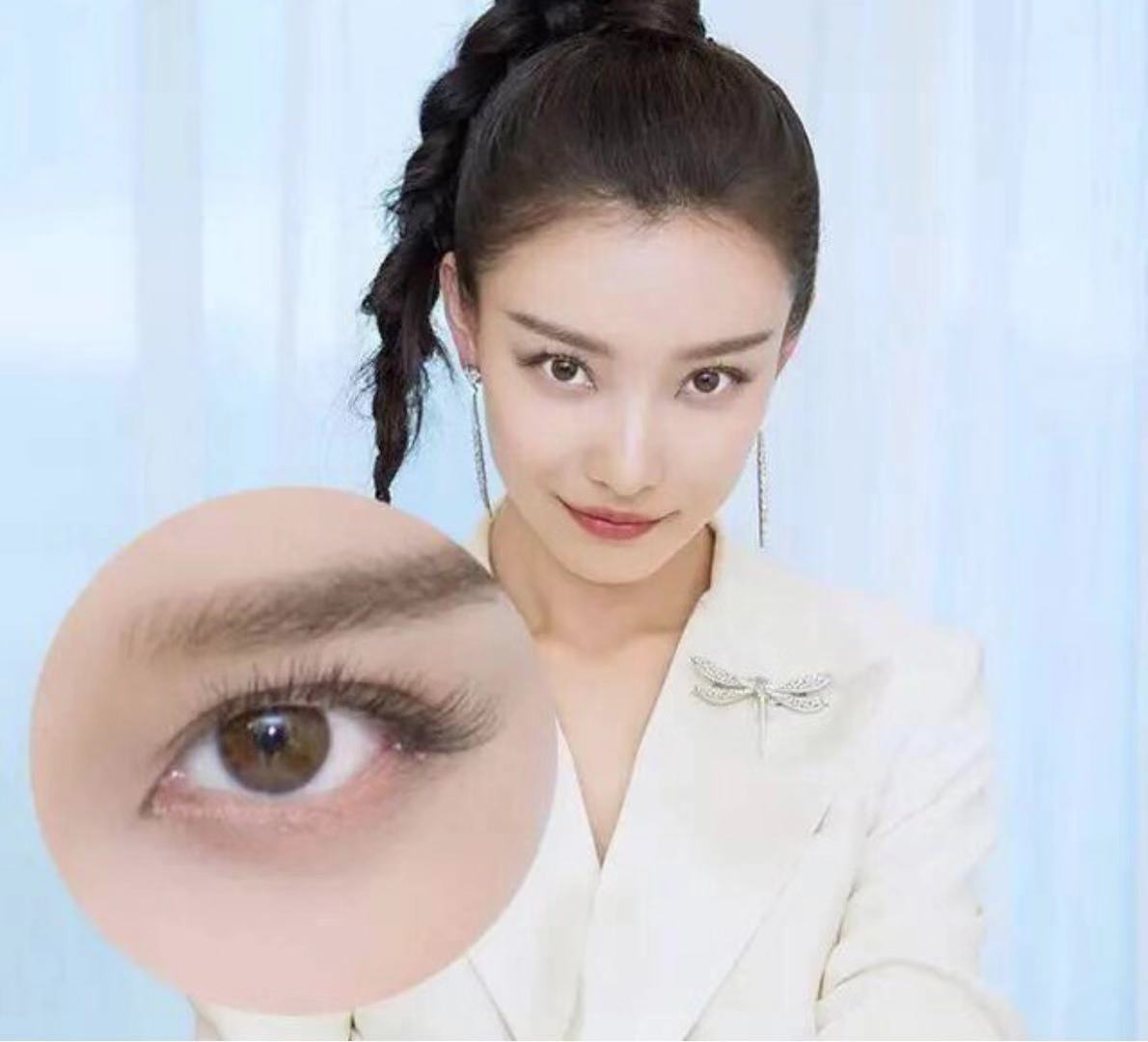 效果就是倪妮这样的,开外眼角手术的主要作用是矫正先天性小眼畸形者