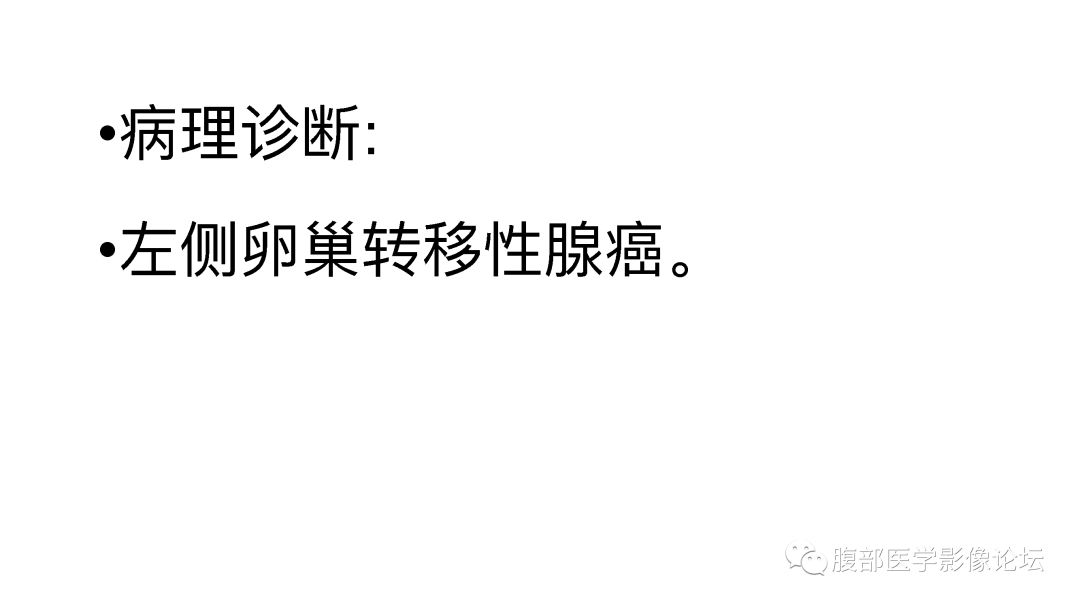 左侧卵巢转移性腺癌