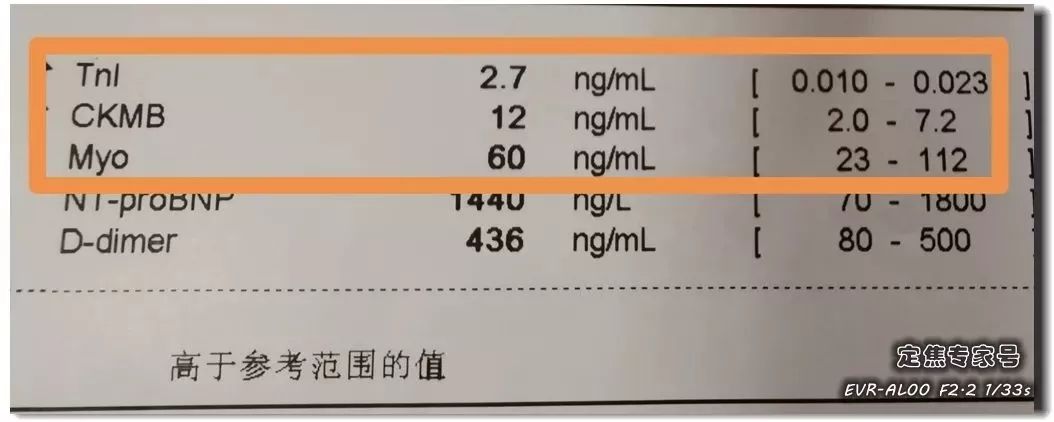 心梗心肌坏死标志物图片