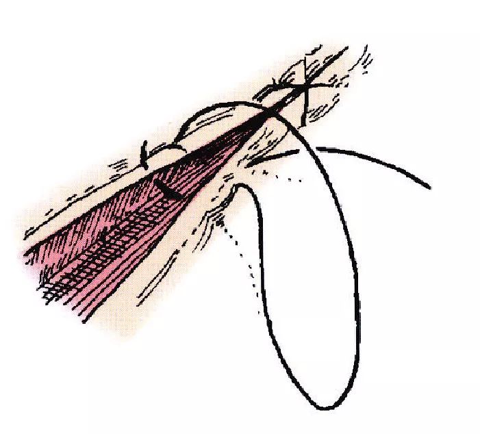 宠医常用的13种外科缝合方法
