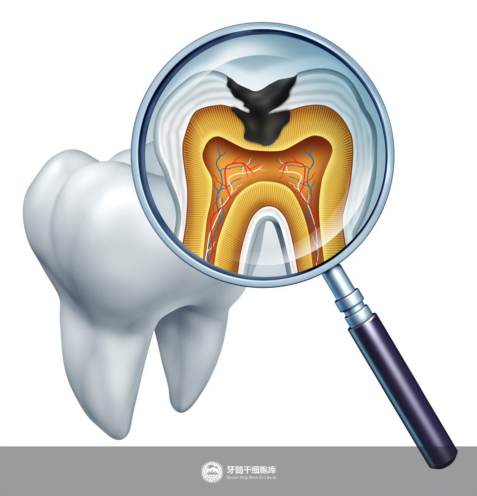 北京口腔医院的牙髓再生术了解一下