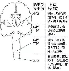 资深急诊专家人体最致命的5个部位教你危急时躲过一劫