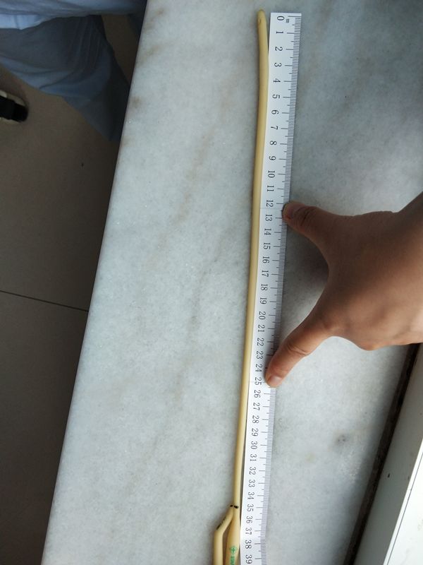 转入的男患者交接时尿管为什么置入深度只有18cm