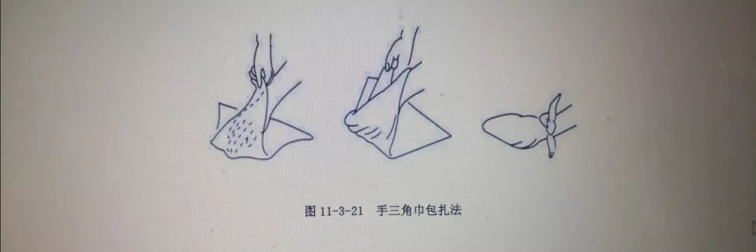 燕尾式三角巾折法图片