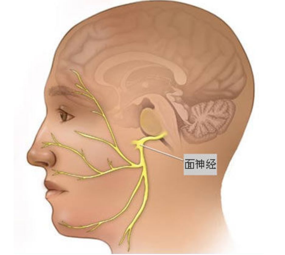 面神经与听神经解剖图图片