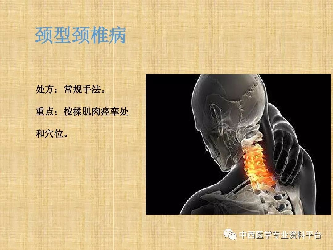 颈椎病推拿