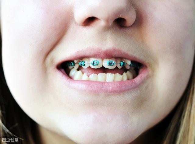 孩子矫正牙齿的最佳年龄是几岁错过了将事倍功半