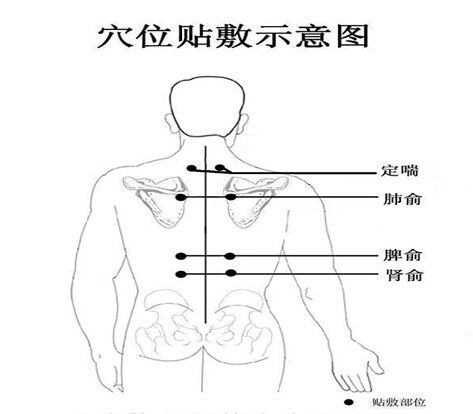 身体亚健康不用愁小小的一帖膏药就能帮到你