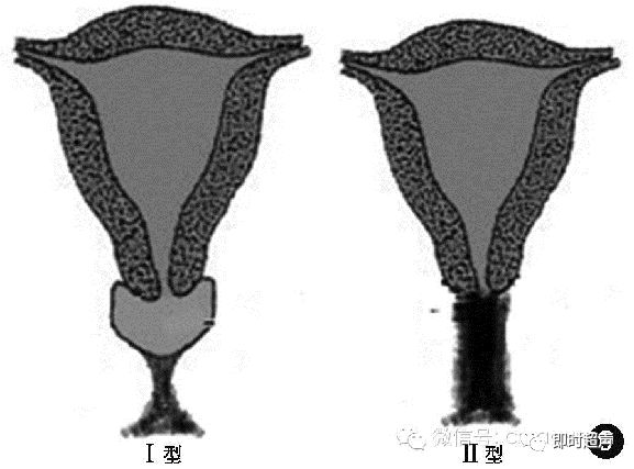 子宫形态异常及子宫内膜周期性变化