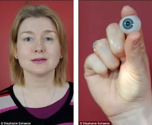 因为戴隐形眼镜他们眼睛长寄生虫眼角膜被撕掉几近失明