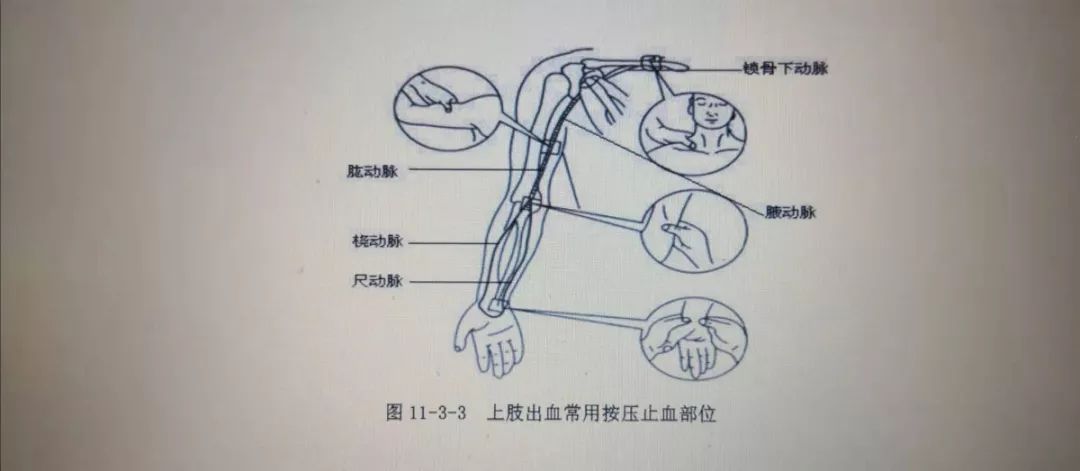 尺动脉的准确位置图片