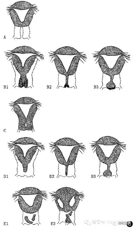 子宫形态异常及子宫内膜周期性变化