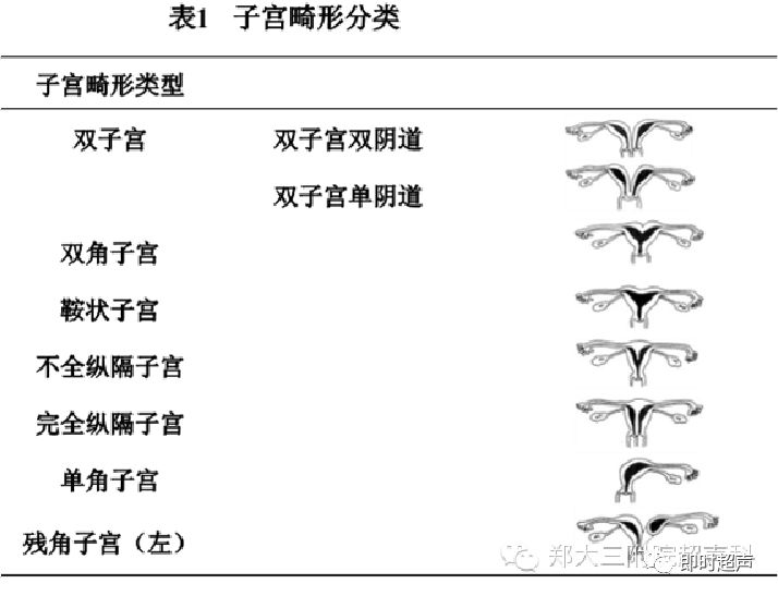 子宫畸形种类图片