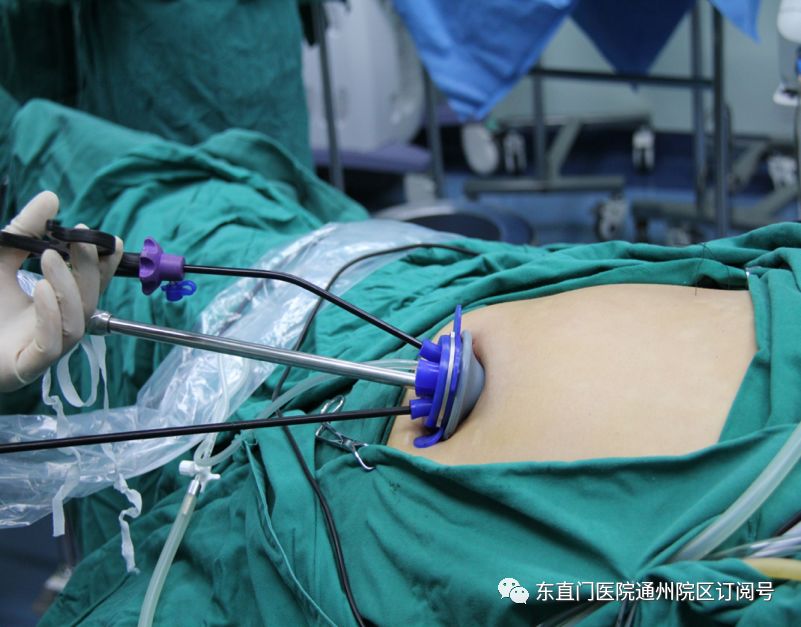 东直门医院代诊挂号服务流程覆盖北京全三甲的简单介绍