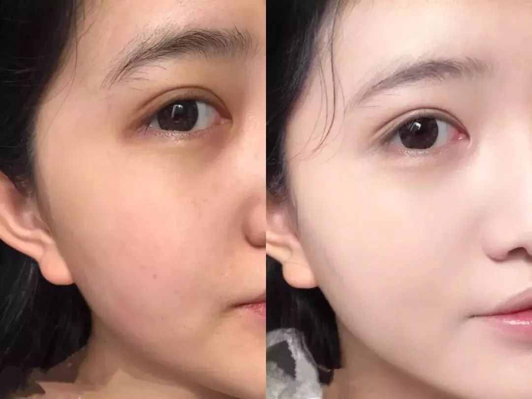 懒girl的裸妆秘密神器 有了ta10秒就能get少女粉嫩肌!_皮肤