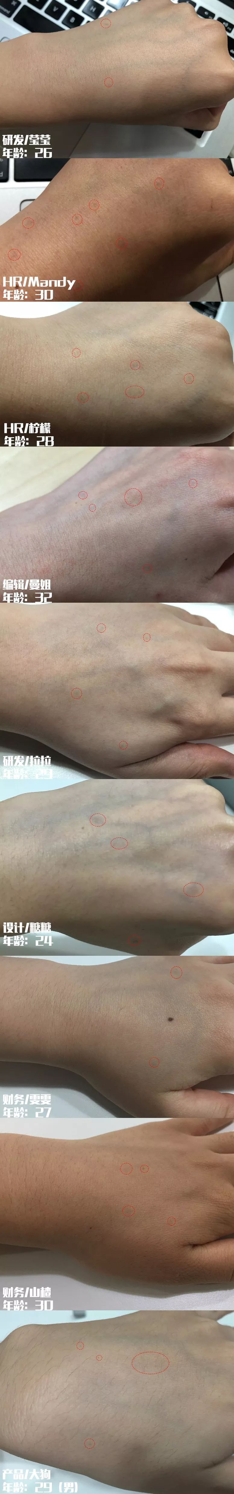 快意恩仇,红尘磨铸大女主!_晒斑