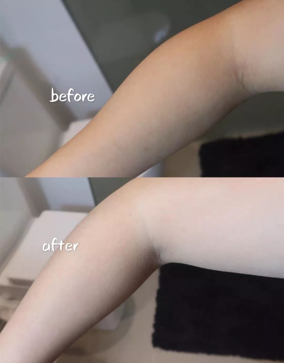 鸡皮肤要天天洗澡吗(鸡皮肤要天天洗澡吗女)