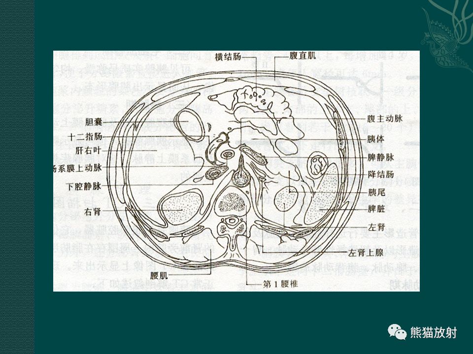 胰腺及脾臟病變丨影像學診斷