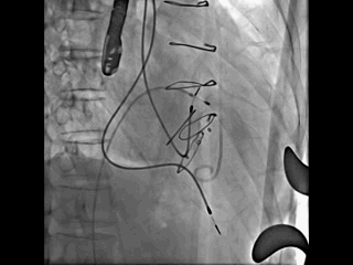 320_240gif 动态图 动图