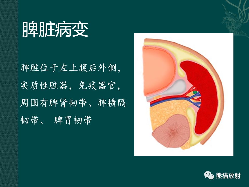 胰腺及脾臟病變丨影像學診斷