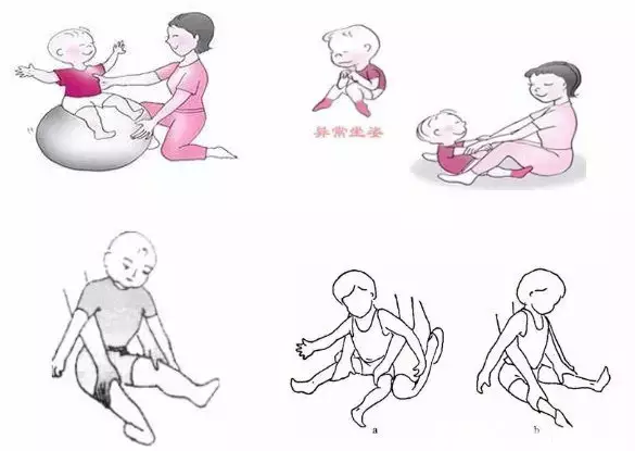 脑瘫儿康复训练,从抬头训练到行走训练,值得收藏