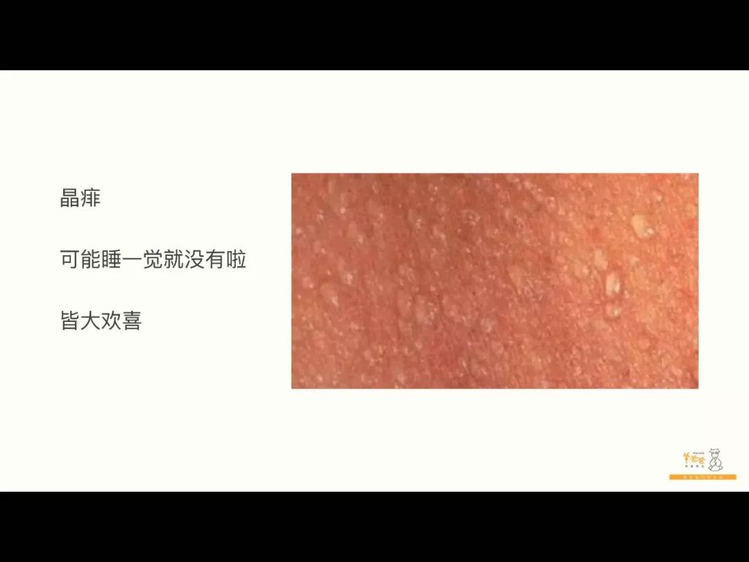 长痱子,到底暗藏什么健康密码?