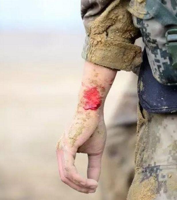 军人浑身是伤疤的照片图片