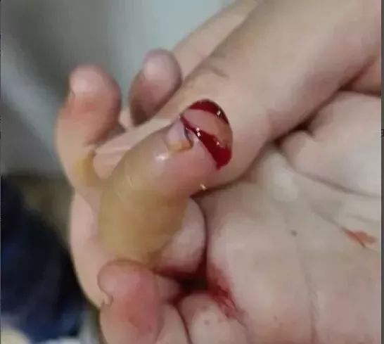 惨!东莞8个月大婴儿被吊扇"斩头",只因亲戚做了这个动作