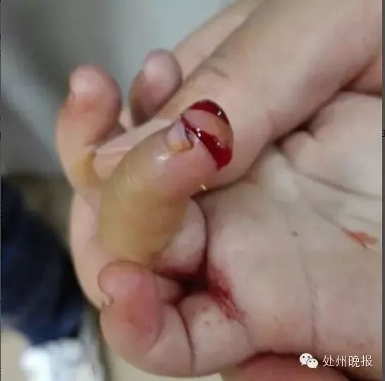 使向运转的电风扇,有人做过实验,马来西亚安邦区,一位25岁的青年,家中