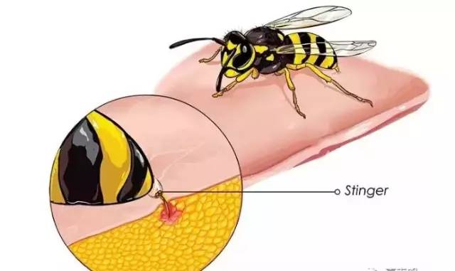马蜂毒素的成分不同,有能分解细胞膜的酶,也有类似乙酰胆碱和5-羟色胺