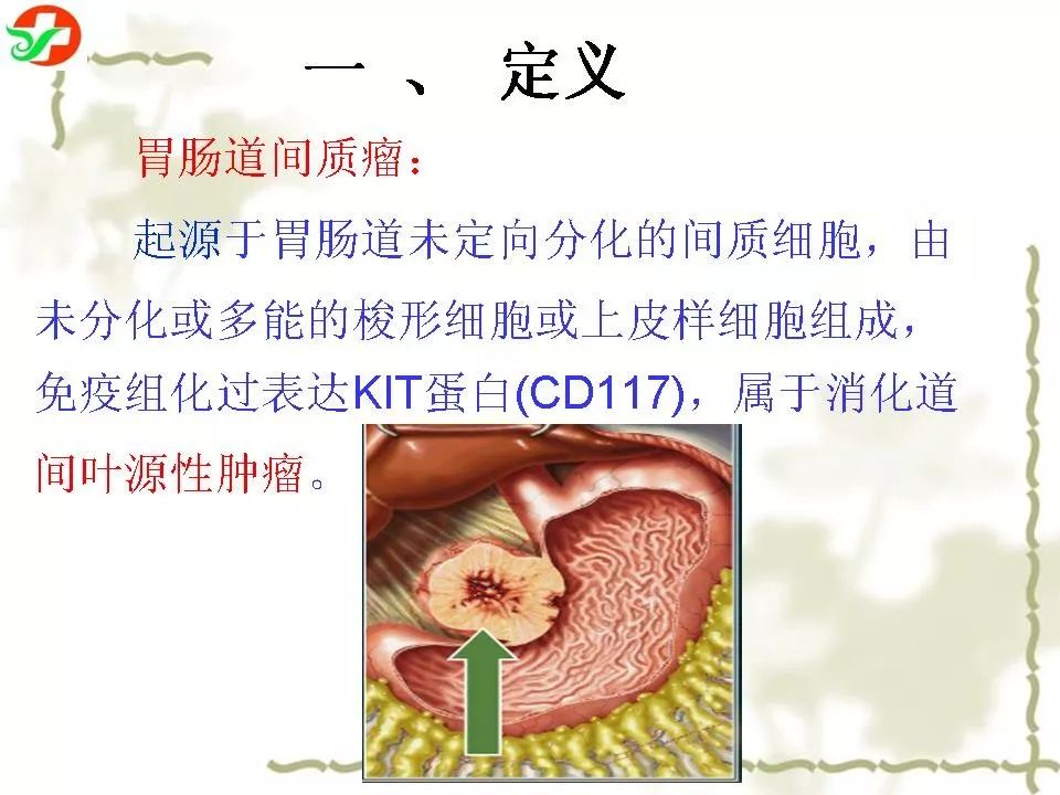 胃腸道間質瘤ctmri診斷影像天地