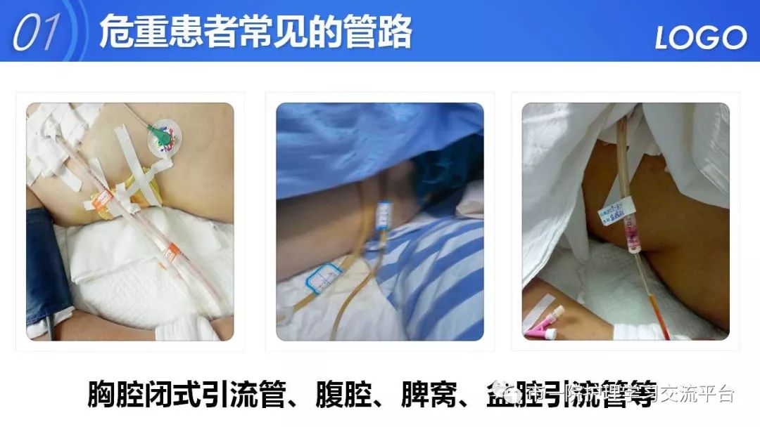 重症患者的管路到底该如何护理ppt教会你